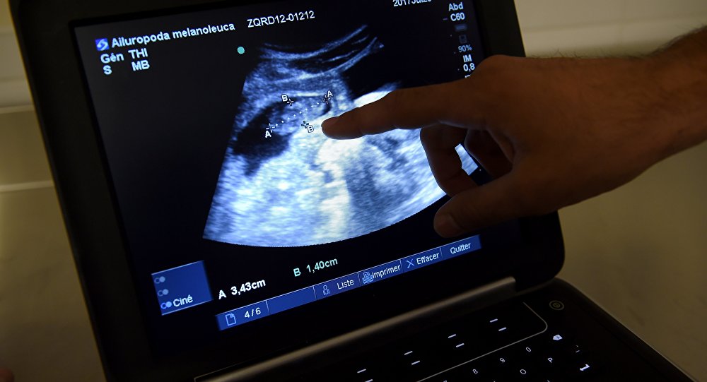 Tüp bebek yöntemiyle hamile kalan kadın başka bir çiftin bebeğini doğurdu