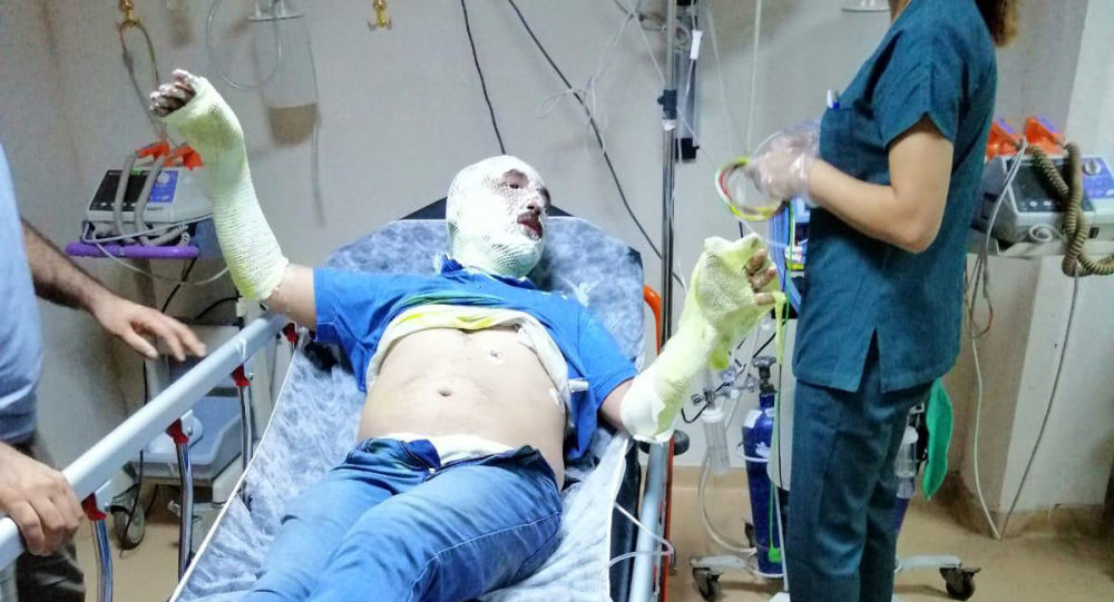 MHP İlçe Başkanı Ağca teknede çıkan yangında yaralandı