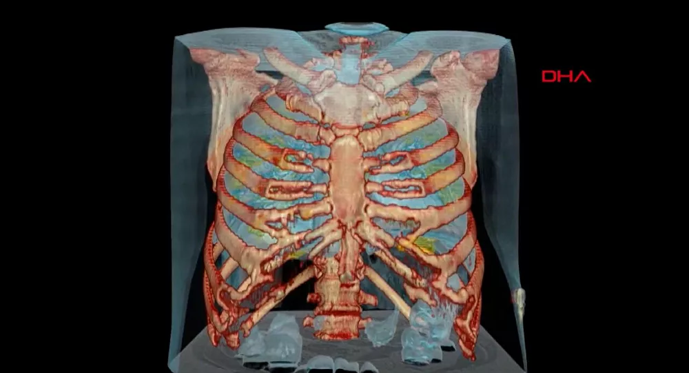 Koronavirüs bulunan akciğerin 3D görüntüsü yayınlandı